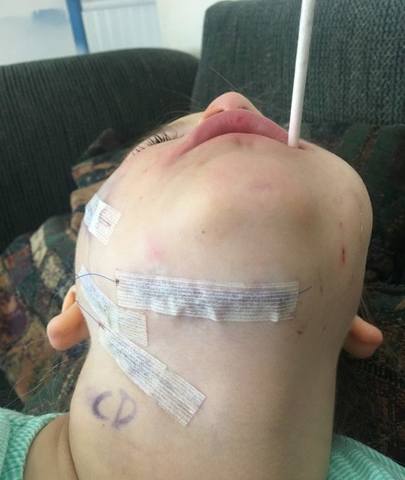 Хаски разорвала 5-летней девочке лицо и сломала челюсть1