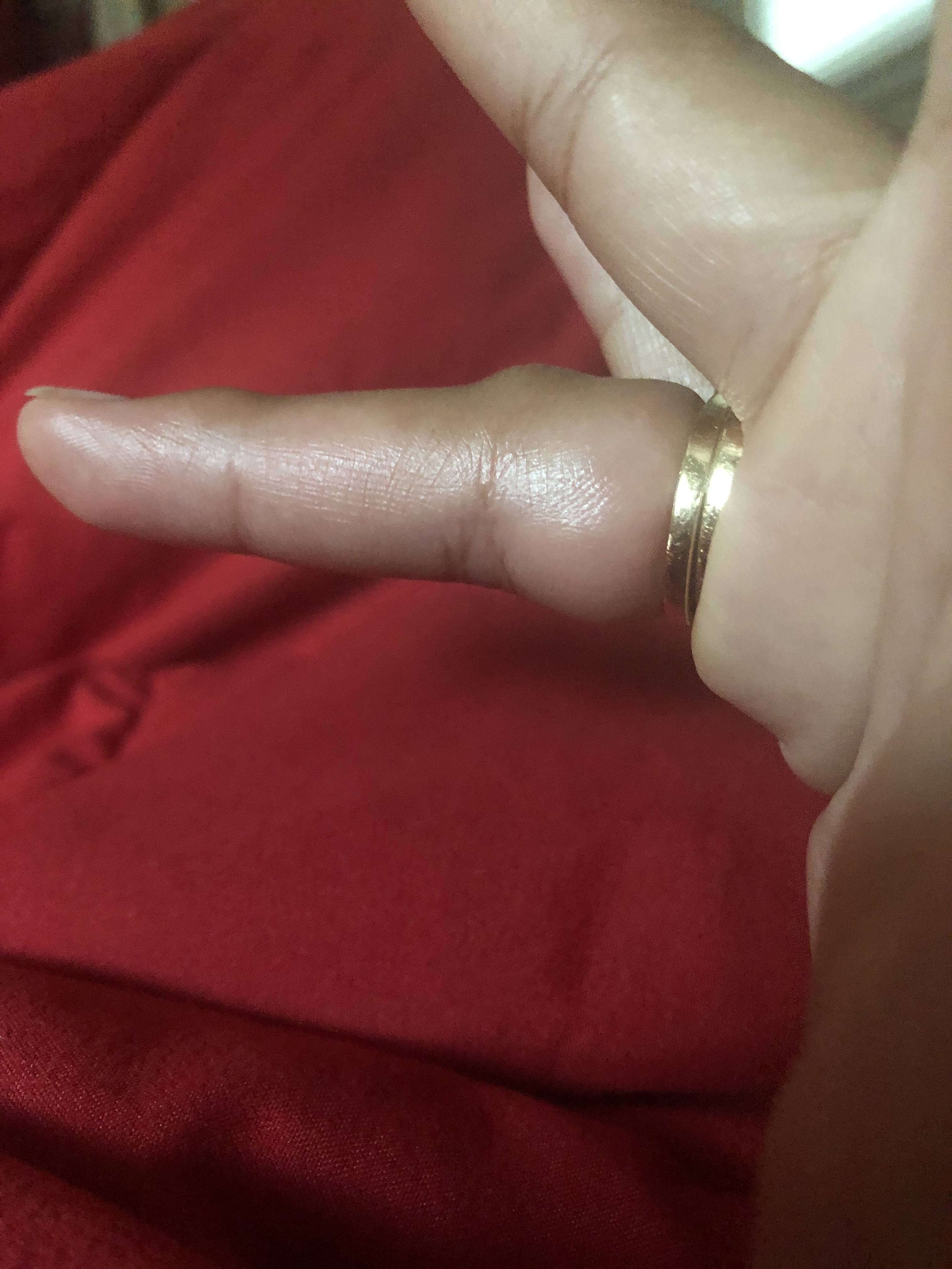 finger