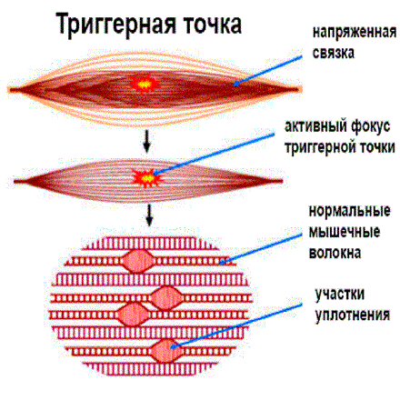 Карта триггерных точек на лице