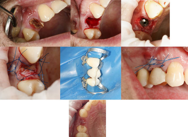 case1