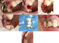 case1