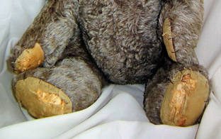 блокадный-мишка ноги