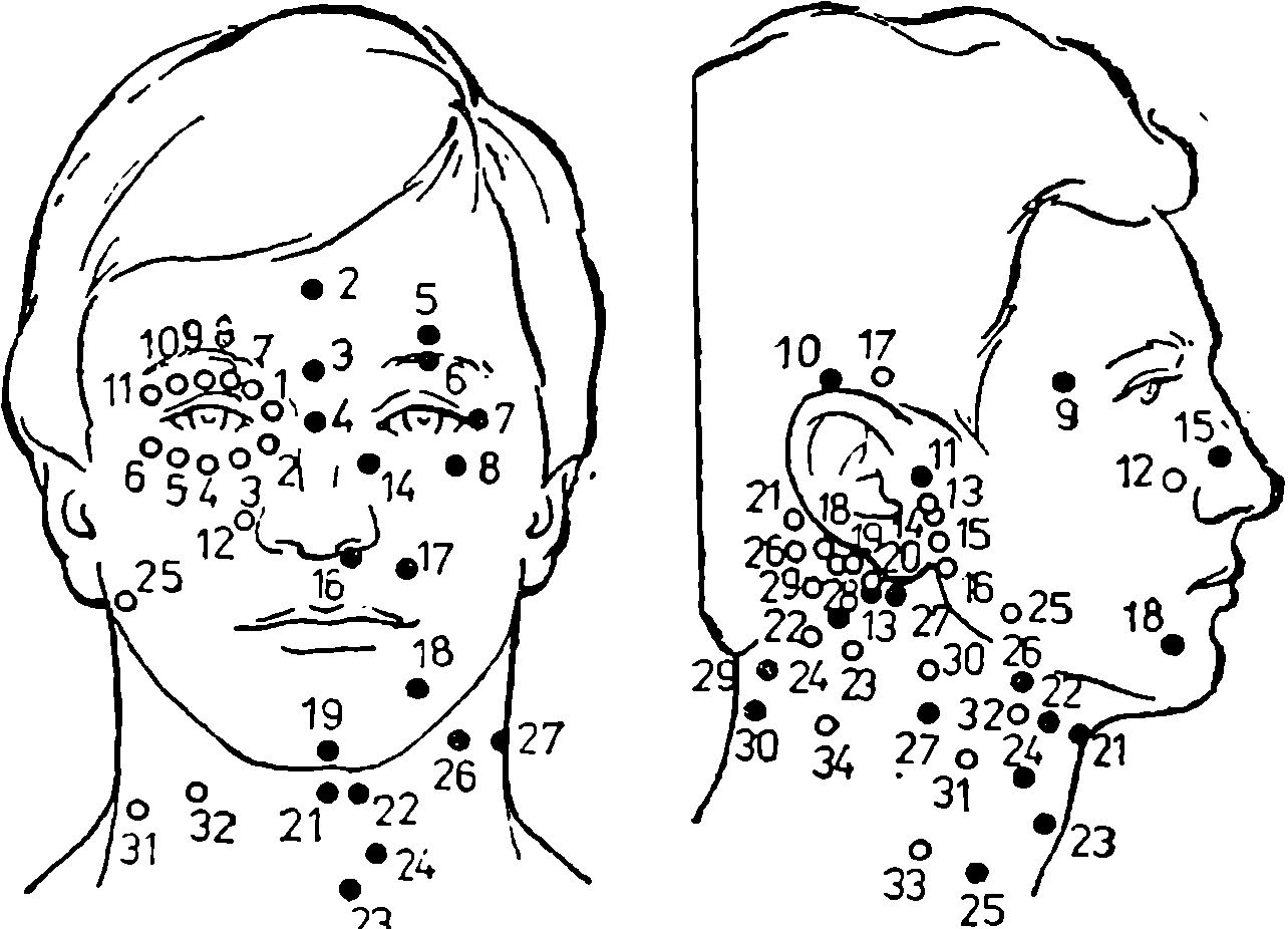 Точка pc. Точки акупунктуры Тай-Ян. Точки на голове. Точки на голове человека. Внемеридианные точки на голове.