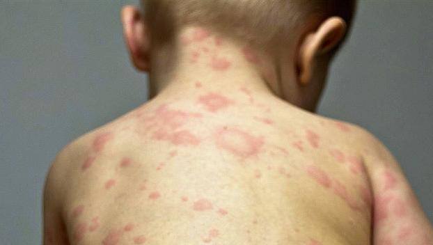 VFL.RU - ваш фотохостинг