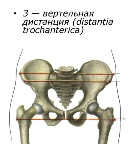 slide-37