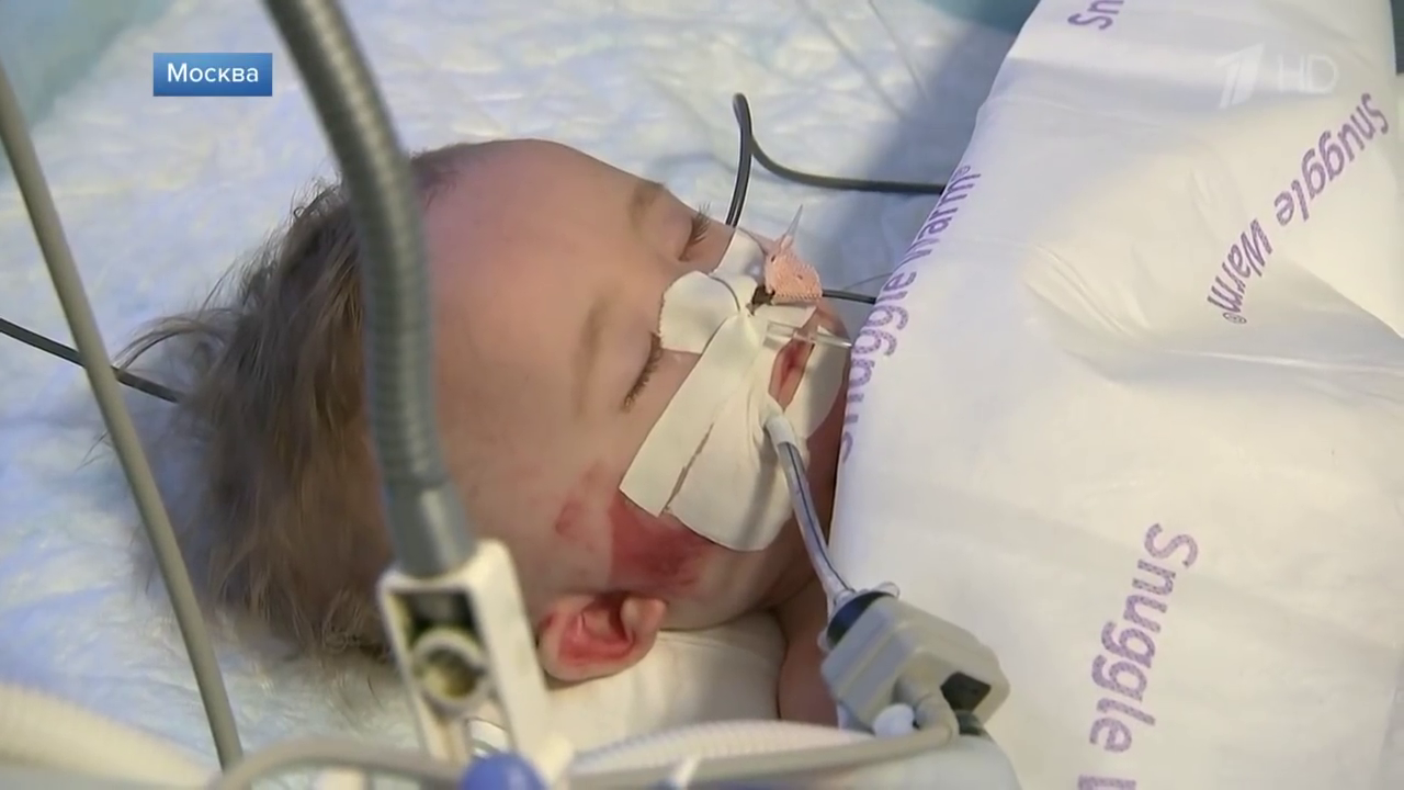 лежит без фиксации шеи