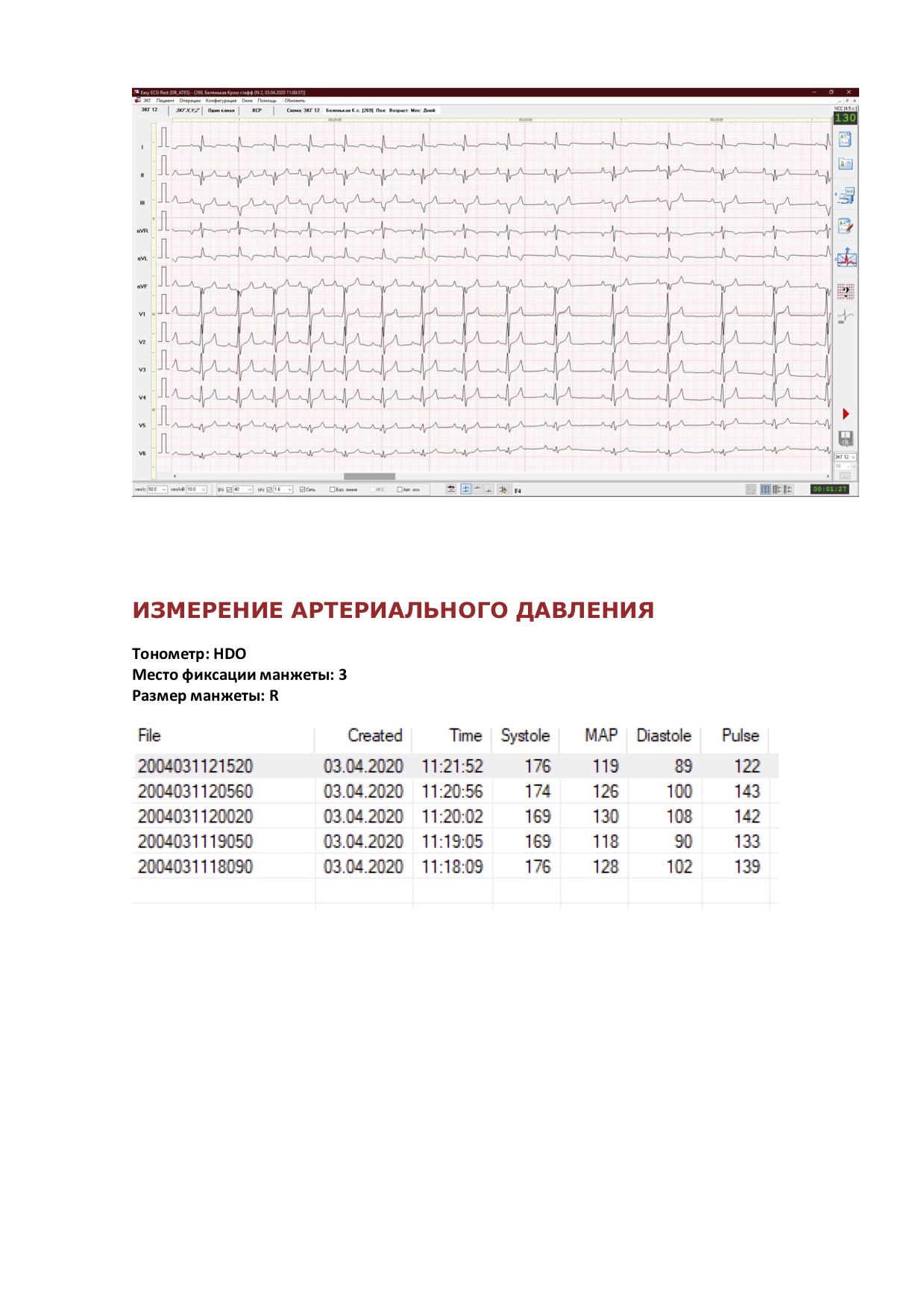 кром 4