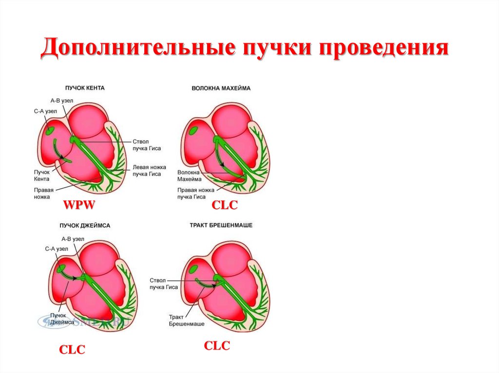 Проведение сердца. Проводящая система сердца при wpw. Проводящая система сердца дополнительные пути. Проводящая система сердца Кента Джеймса. Дополнительные пучки в проводящей системе сердца.