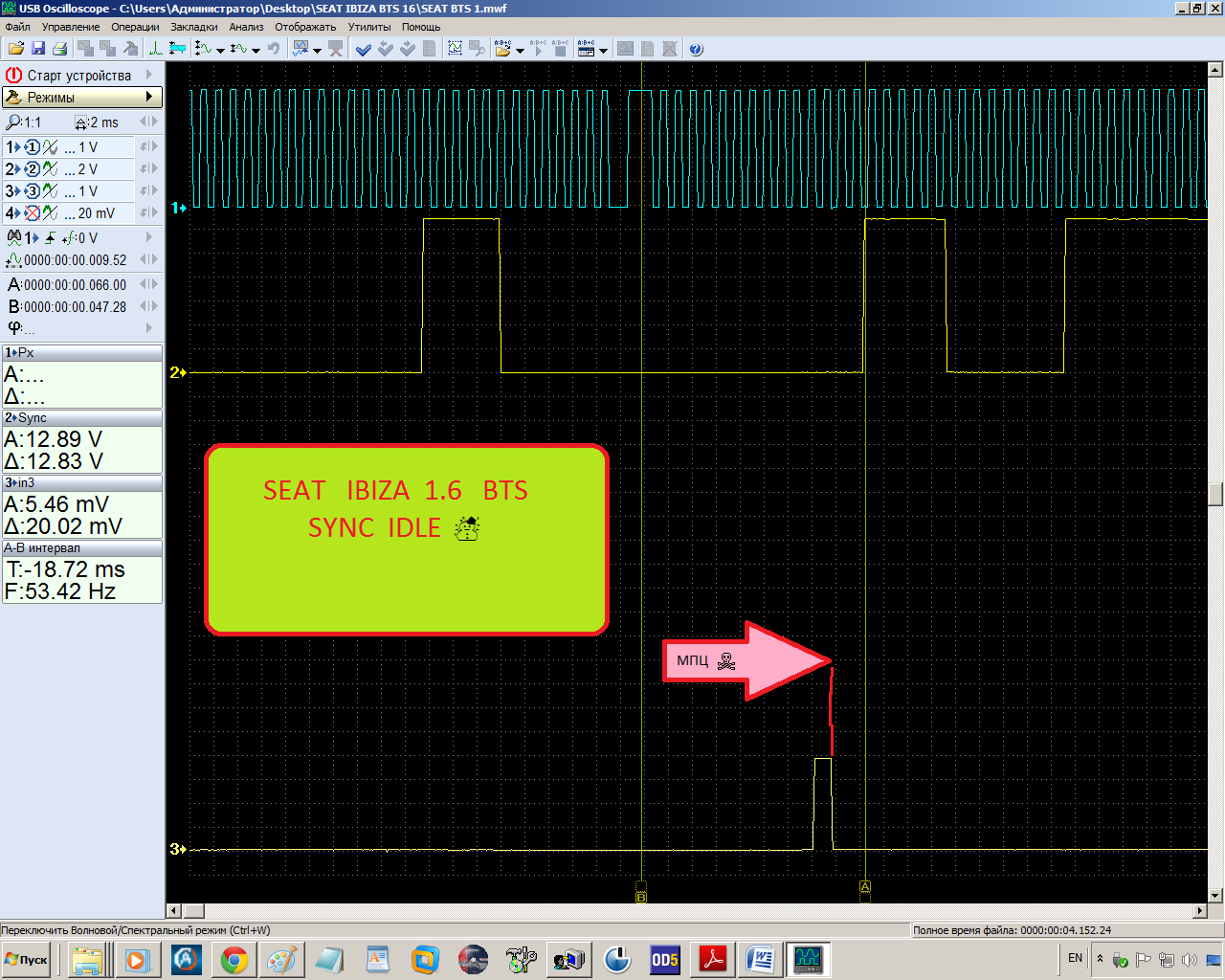 VAG BTS 1.6 SYNC IDLE