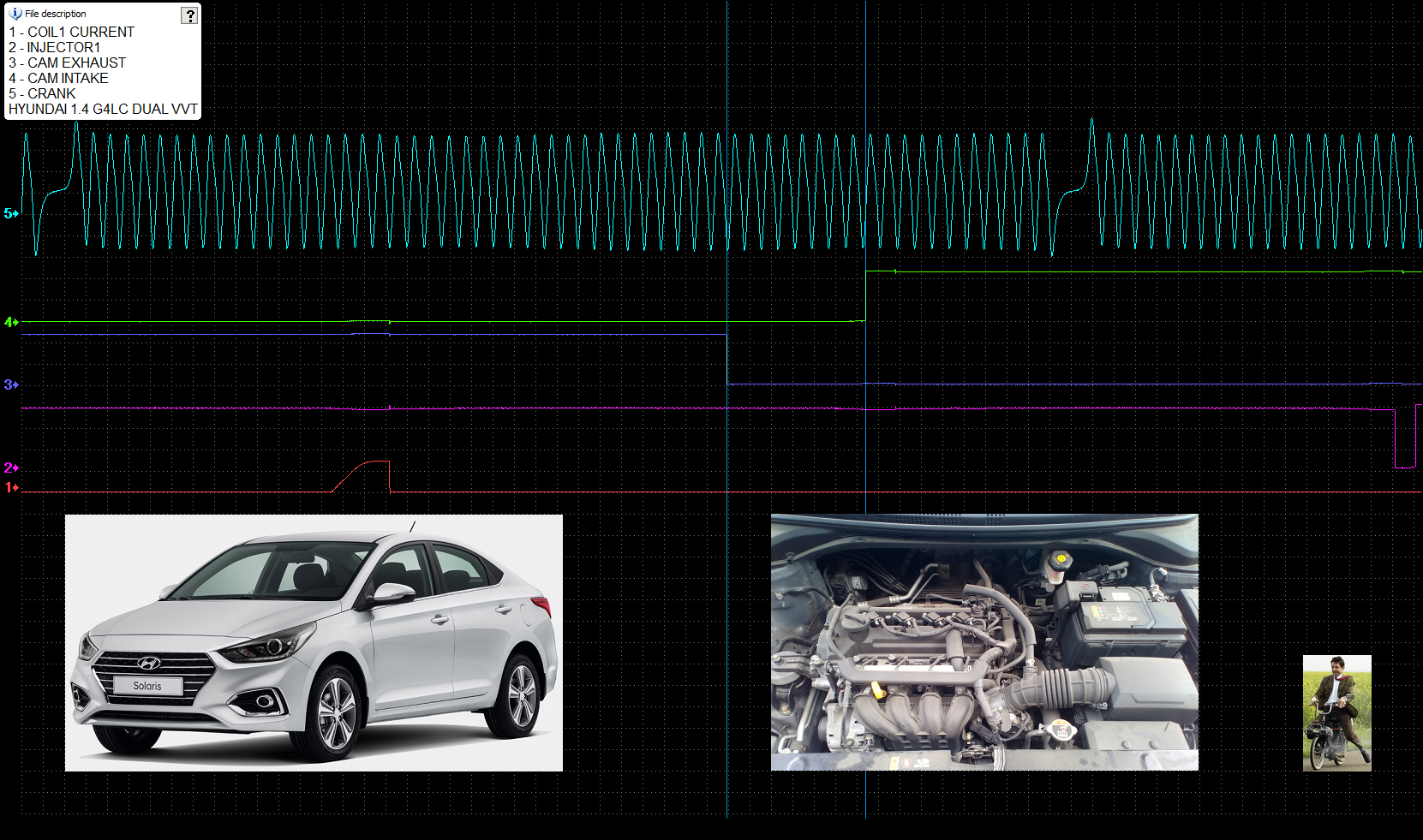 HYUNDAI 1.4 G4LC sync 2ms