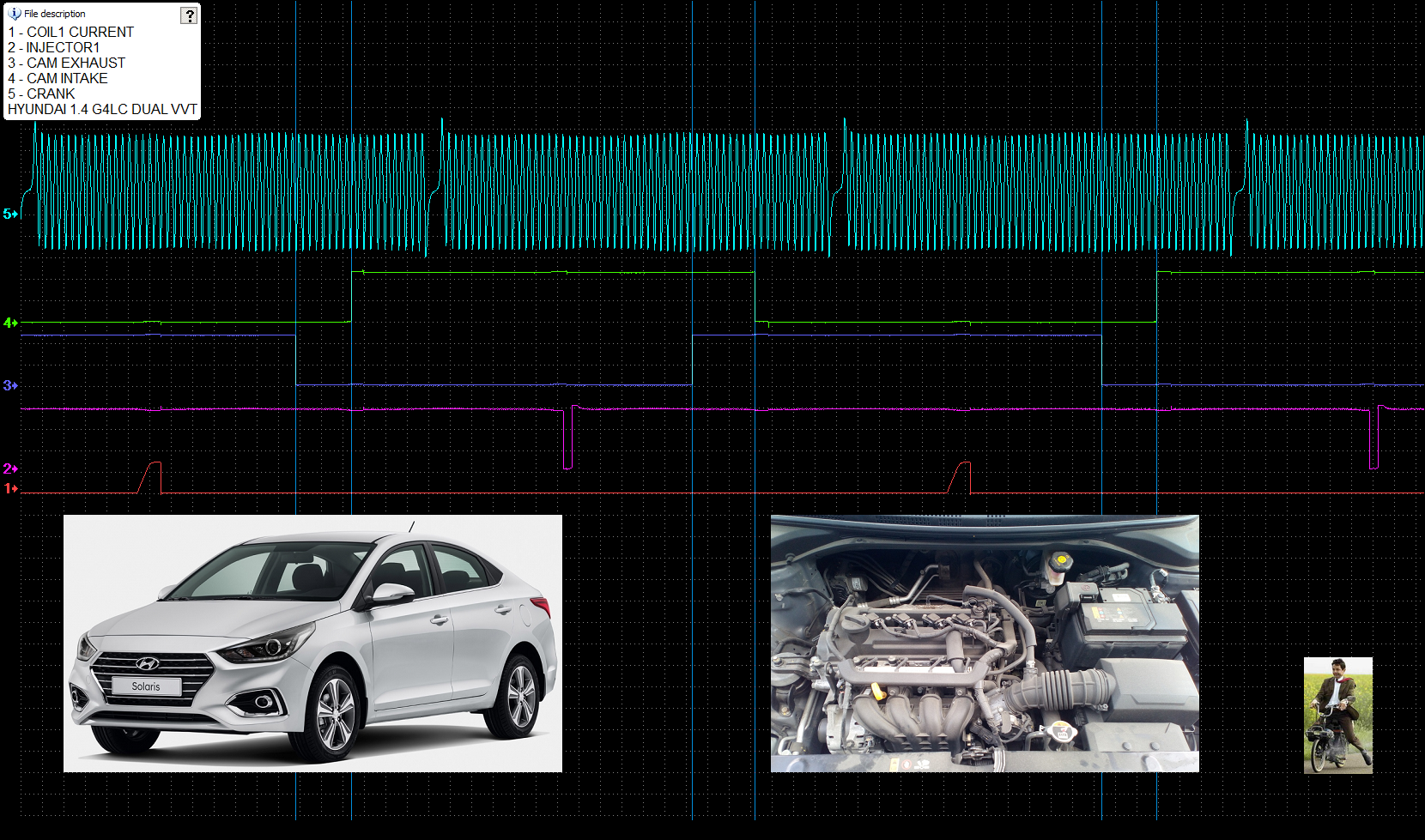 HYUNDAI 1.4 G4LC sync 5ms