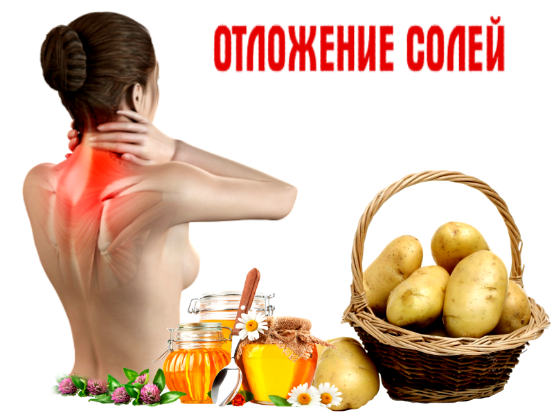 Соль в суставах симптомы. Отложение солей в организме. диета при отложении солей. где откладывается соль. при отложении солей.