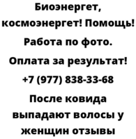 После ковида выпадают волосы у женщин отзывы