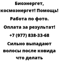 Сильно выпадают волосы после ковида что делать