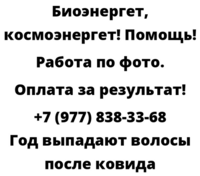 Год выпадают волосы после ковида