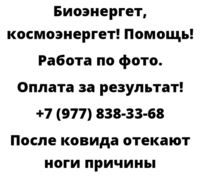 После ковида отекают ноги причины