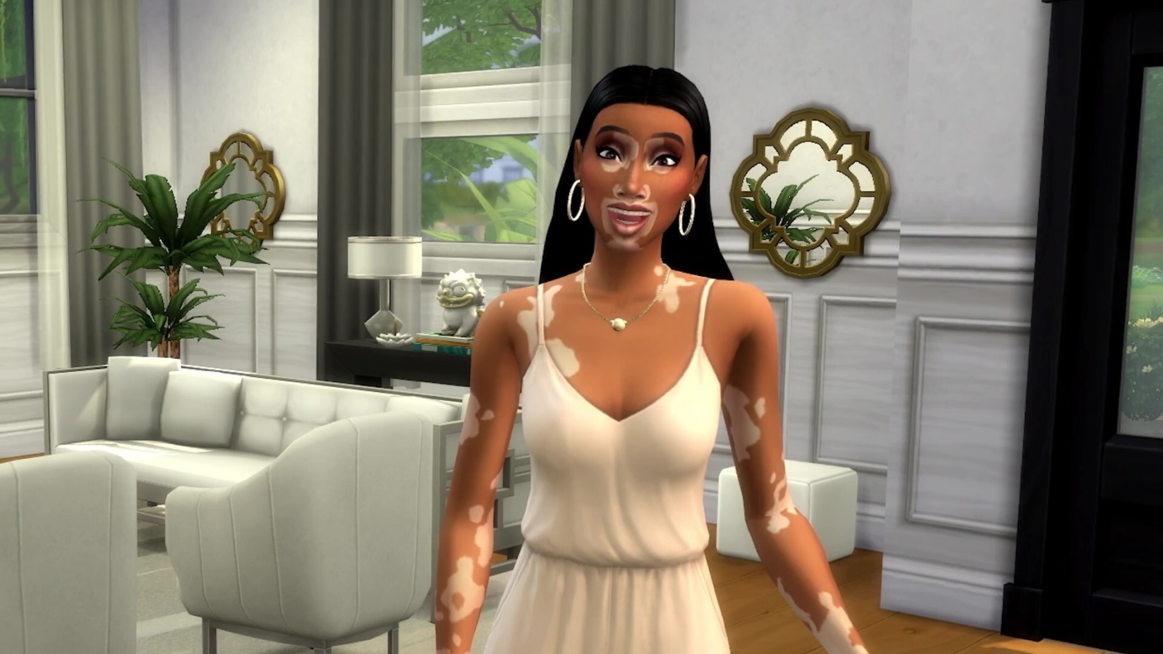 ts4-winnie-vitiligo-blog-2.jpg?im=AspectCrop=(16,9),xPosition=0.5,yPosition=0.5&w=1677