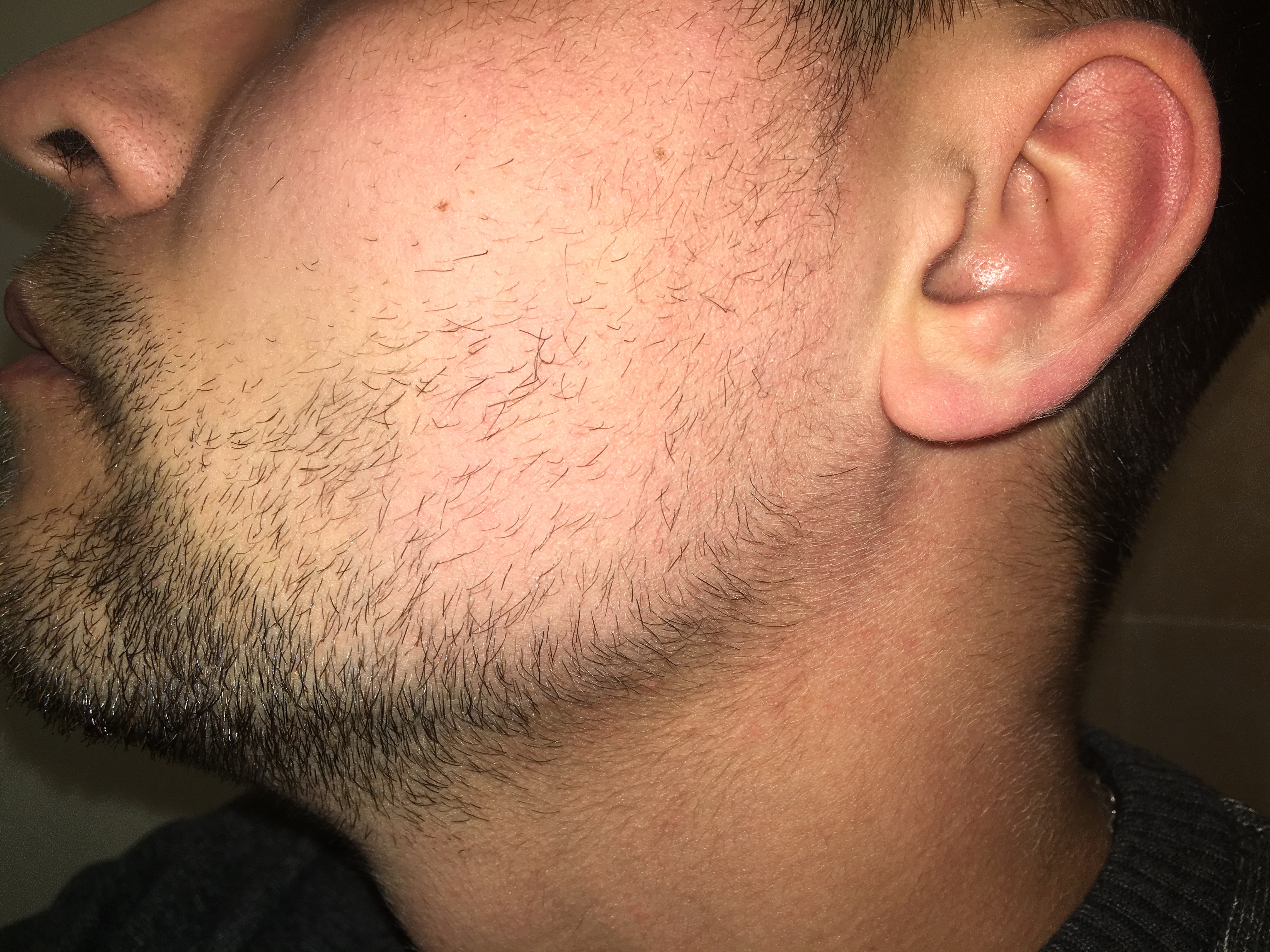 Волосы на бороде растут в одну сторону