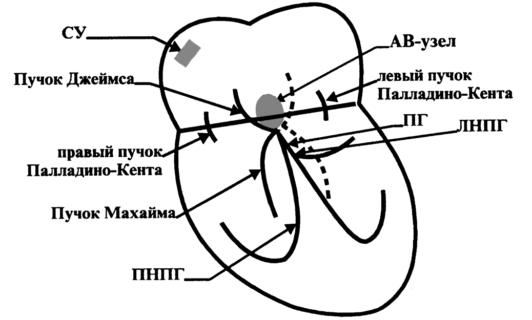 Сердечный путь. Пучки Кента Джеймса Махайма. Пучок Махайма на ЭКГ. Проводящая система сердца Кента Джеймса. Проводящая система сердца пучок Кента.